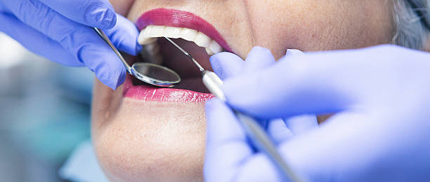 Best Emergency Root Canal Treatment in Lauderdale Lakes, WI